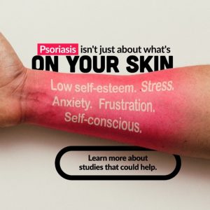 Psoriasis isn't just about what's on your skin