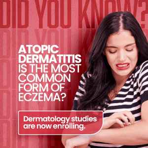 Atopic dermatitis is the most common form of eczema