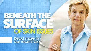 Beneath the surface of skin issues